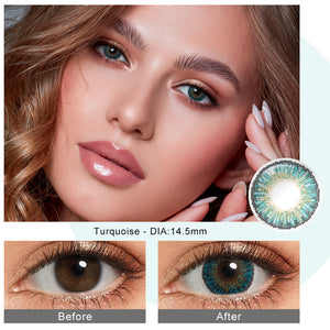 3 Tone Turquoise Coloured Contacts | Yearly